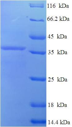 Human C9orf163 Protein (Recombinant His-SUMO)
