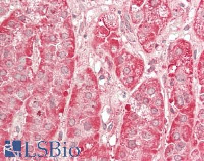 IHC-plus™ DDX / AKR1C3 Antibody