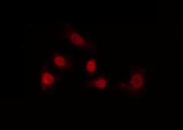 HOXD12 Antibody