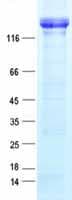 Human ERBB2 / HER2 Protein (Recombinant DDK,C-terminus)