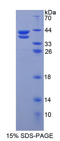 Human RETNLB / RELM-Beta Protein (Recombinant His-GST-S)