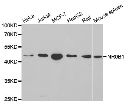 NR0B1 / DAX1 Antibody