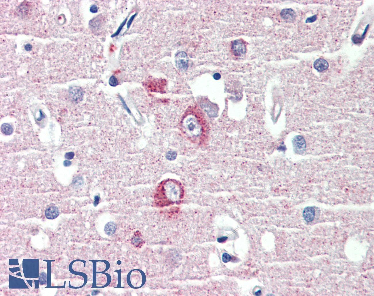 IHC-plus™ Polyclonal Goat anti-Human DLGAP1 Antibody (aa391-405, IHC)