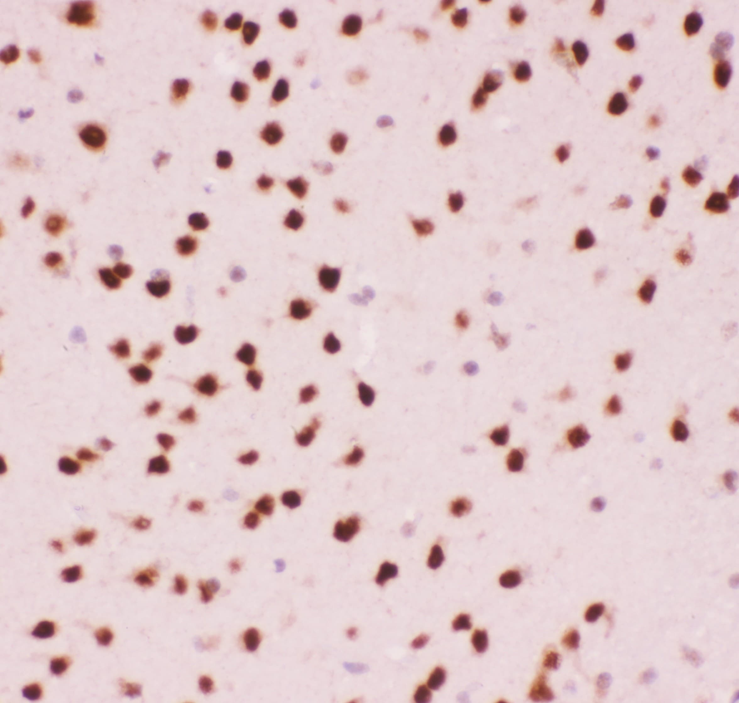 ATF2 Antibody (aa93-450)