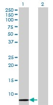SCGB1A1 / Uteroglobin Antibody (clone 1F7)