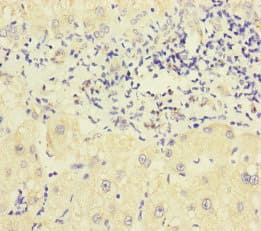Polyclonal Rabbit anti-Human P2RX3 / P2X3 Antibody (IHC, WB)
