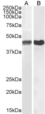 PathPlus™ ACTA2 / Smooth Muscle Actin Antibody (aa1-50)