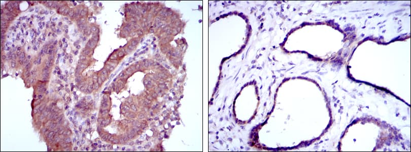 MTHFR Antibody (clone 5D3)