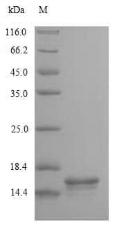 Human CD3E Protein (Recombinant 6His, N-terminus)