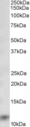 IHC-plus™ Polyclonal Goat anti-Human S100A8 / MRP8 Antibody (aa49-62, IHC, WB)
