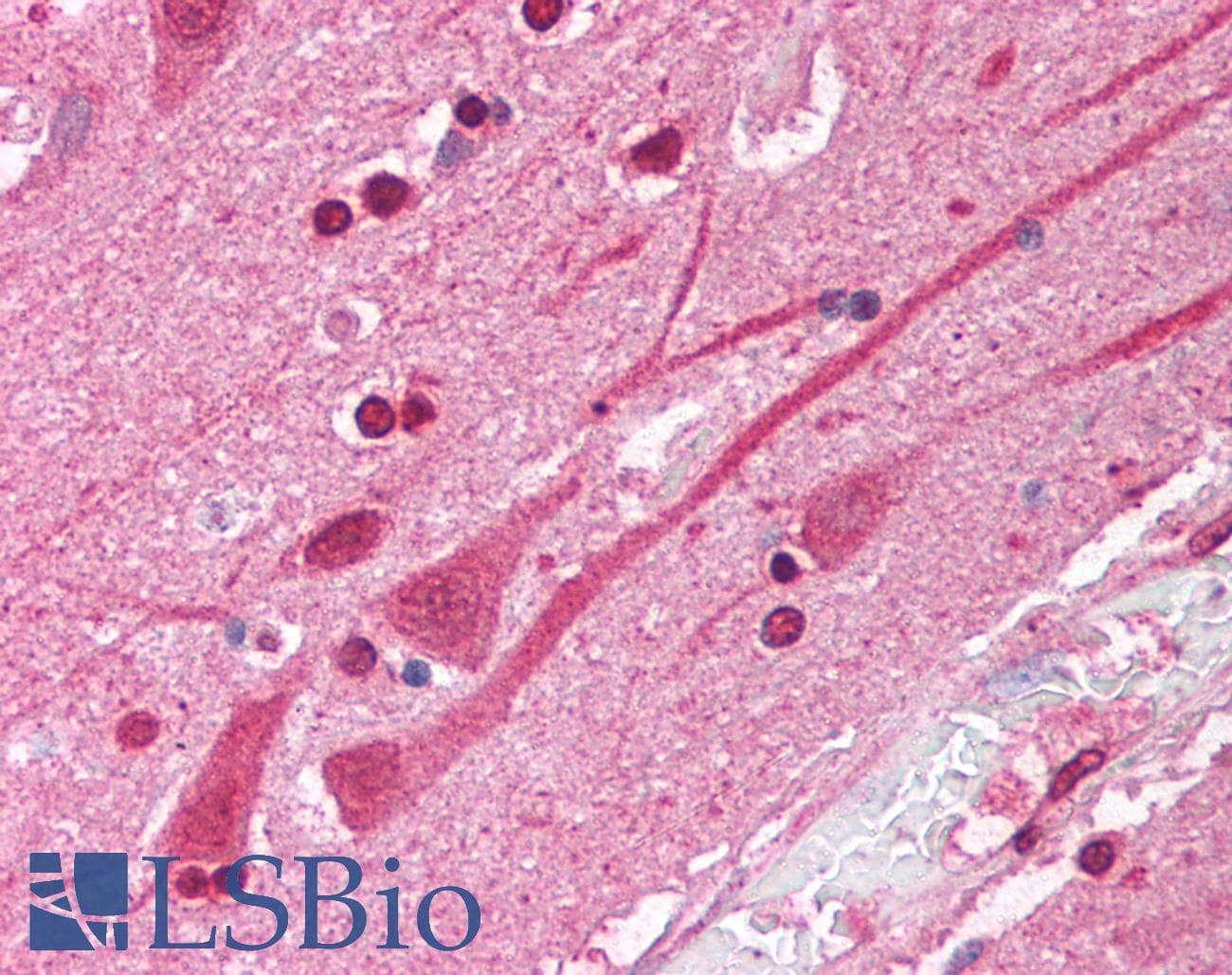 ATF1 Antibody (N-Terminus)