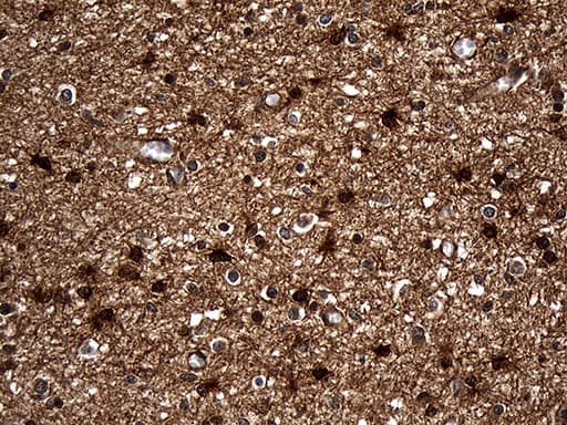 DCLK / DCLK1 Antibody (aa193-492, clone OTI1F8)