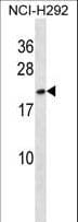 HMGB3 Antibody (aa50-79)