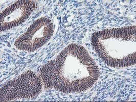 Monoclonal Mouse anti-Human ALOX15 / 15-Lipoxygenase Antibody (clone OTI3G8, IHC, IF, WB)