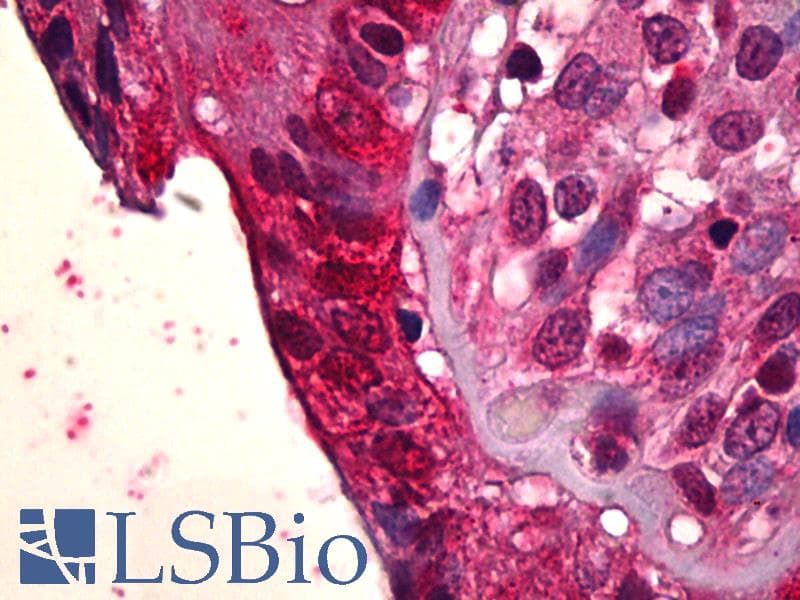 IHC-plus™ PLK1 / PLK-1 Antibody