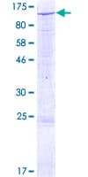 Human SEMA3G / Semaphorin 3G Protein (Recombinant GST)