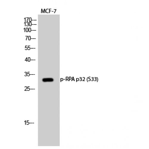 Polyclonal Rabbit anti-Human RPA2 / RFA2 / RPA34 Antibody (10-90 aa, WB)