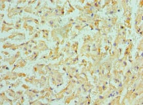 Polyclonal Rabbit anti-Human BMF Antibody (aa1-184, IHC)