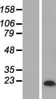 MAL Protein (Over-Expression Lysate Myc-DDK (Flag))