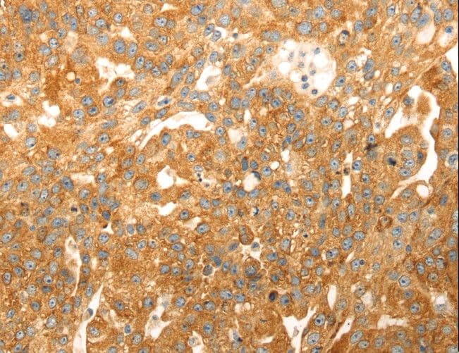 CAPN1 / Calpain 1 Antibody