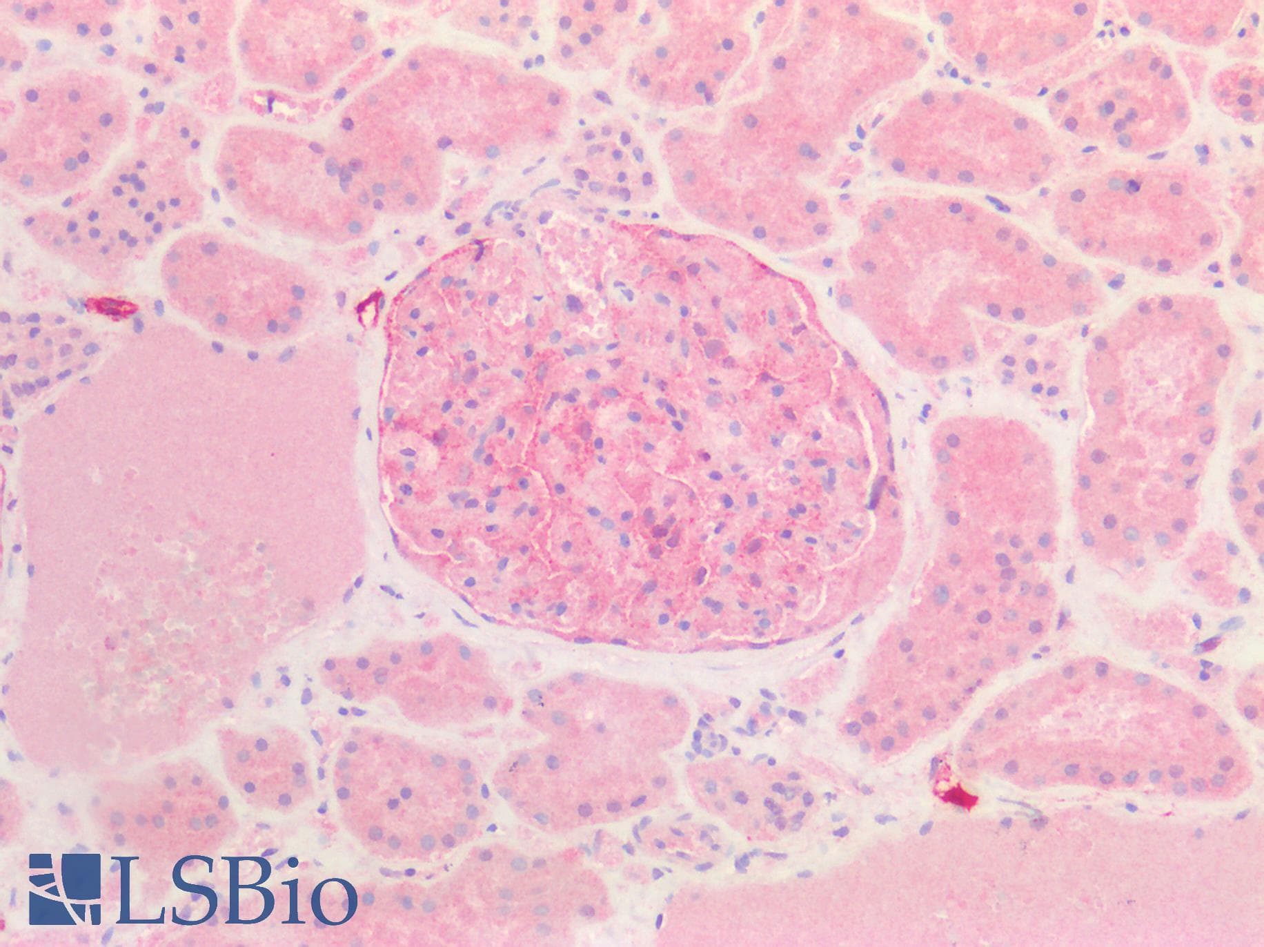 IHC-plus™ Polyclonal Rabbit anti-Human PDPN / Podoplanin Antibody (IHC, WB)