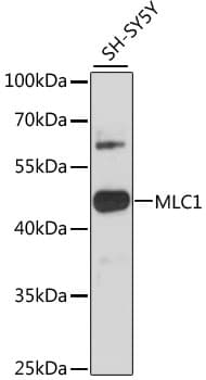 Polyclonal Rabbit anti-Human MLC1 / MLC Antibody (WB)