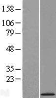 Human C21orf119 Protein (Over-Expression Lysate Myc-DDK (Flag))