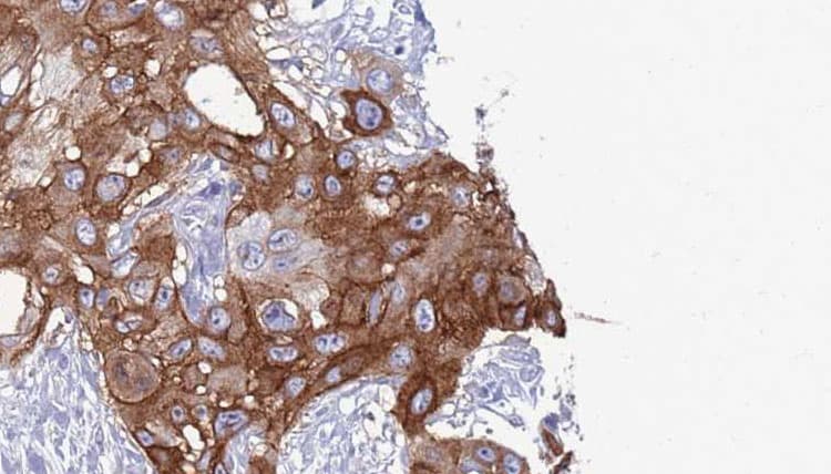 ITGAX / CD11c Antibody