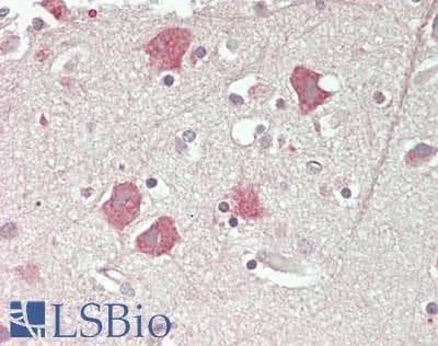 IHC-plus™ RAPGEF3 / EPAC Antibody