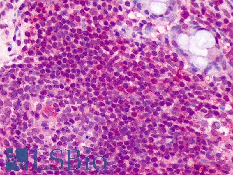 IHC-plus™ CCDC50 Antibody (aa468-481)