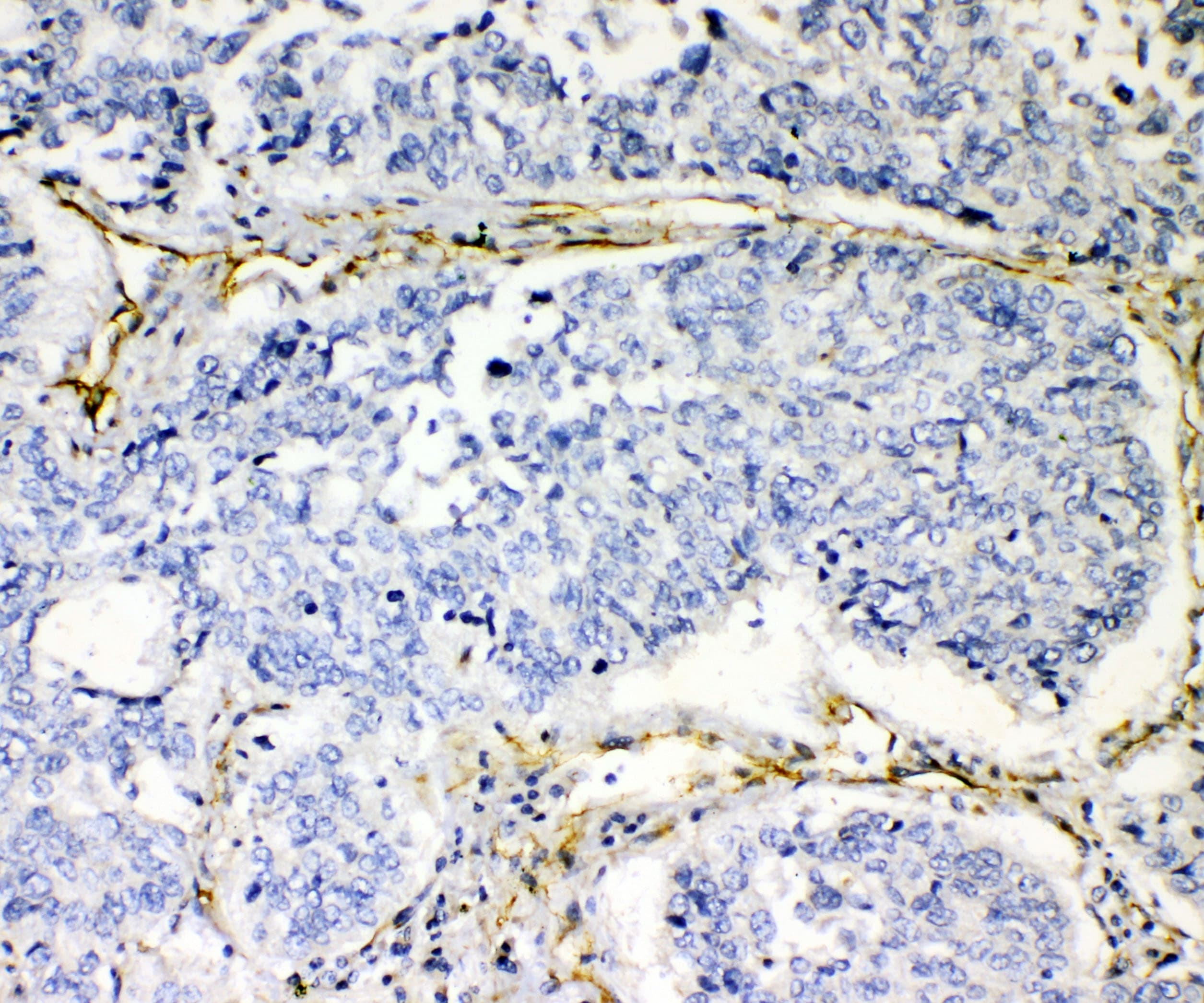 Polyclonal Rabbit anti-Human CD144 / CDH5 / VE Cadherin Antibody (WB)