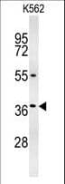 Polyclonal Rabbit anti-Human ZGLP1 Antibody (aa85-112, WB)