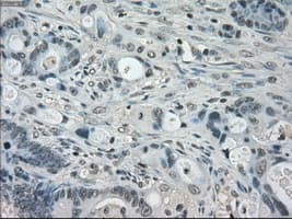 Monoclonal Mouse anti-Human BUB1B / BubR1 Antibody (clone OTI15E11, IHC, IF, WB)