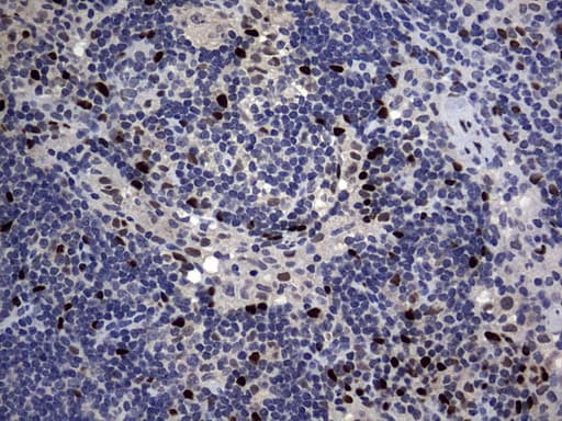Monoclonal Mouse anti-Human PRX-1 / PRRX1 Antibody (clone OTI6A4, IHC, WB)