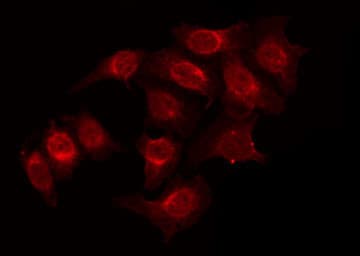 ARHGAP22 / RhoGAP2 Antibody