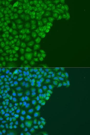 DAPK2 / DAP Kinase 2 Antibody