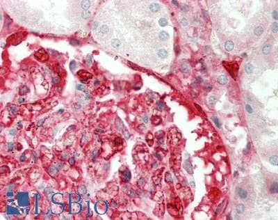 IHC-plus™ A2M / Alpha-2-Macroglobulin Antibody