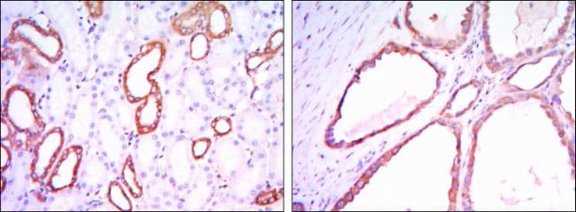 HK1 / Hexokinase 1 Antibody (clone 3A10)