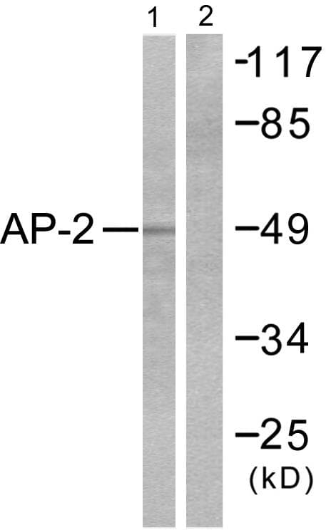 TFAP2A / AP-2 Antibody