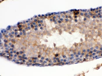IDH1 / IDH Antibody
