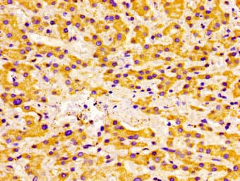 Polyclonal Rabbit anti-Human ACADVL Antibody (IHC, IF, WB)