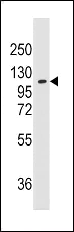 Polyclonal Rabbit anti-Human AARS Antibody (aa61-91, IHC, WB)