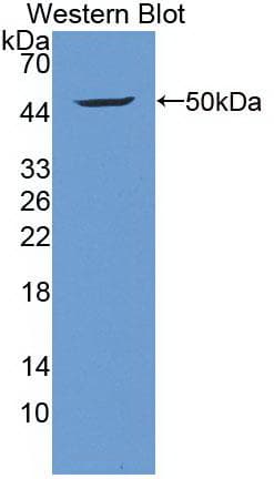 IGF1 Antibody (clone C1)