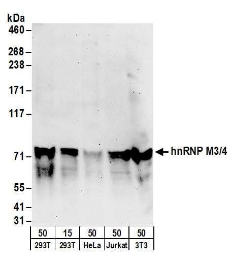 EXOSC1 / CSL4 Antibody (aa145-195)