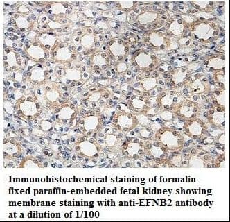 Polyclonal Rabbit anti-Human EFNB2 / Ephrin B2 Antibody (aa31-225, IHC, WB)