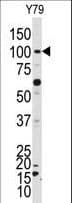NEK4 Antibody (aa793-824)