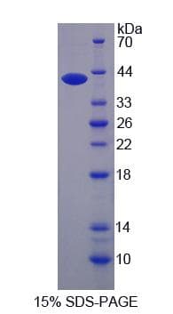 Human AHNAK Protein (Recombinant His-S)