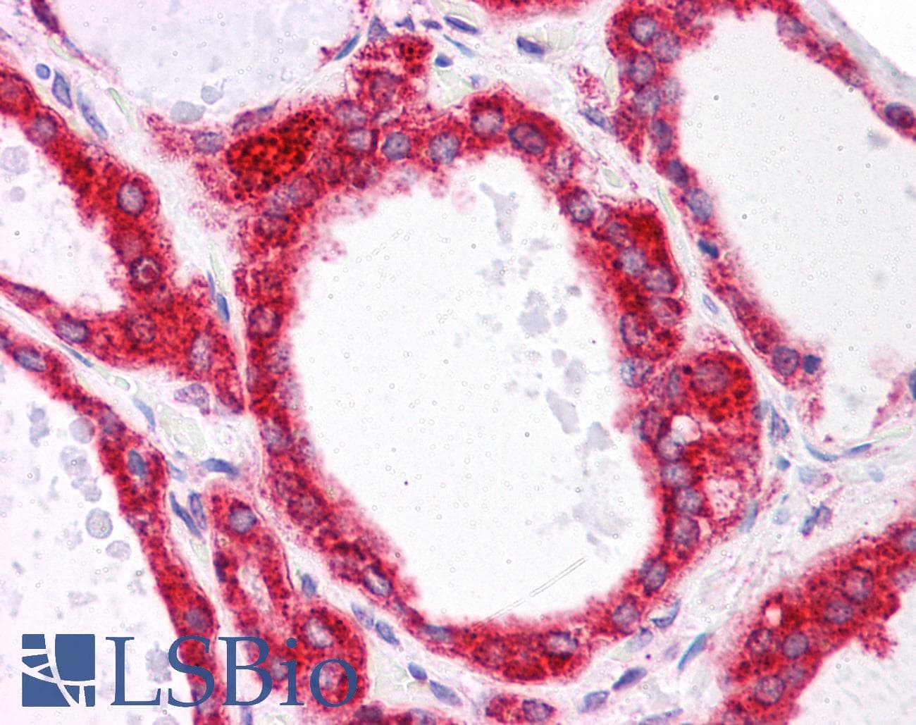 IHC-plus™ IRAK1 / IRAK Antibody (clone 3F7)