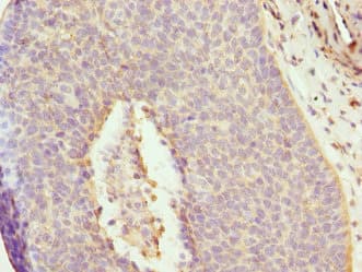 Polyclonal Rabbit anti-Human DAAM2 Antibody (IHC)