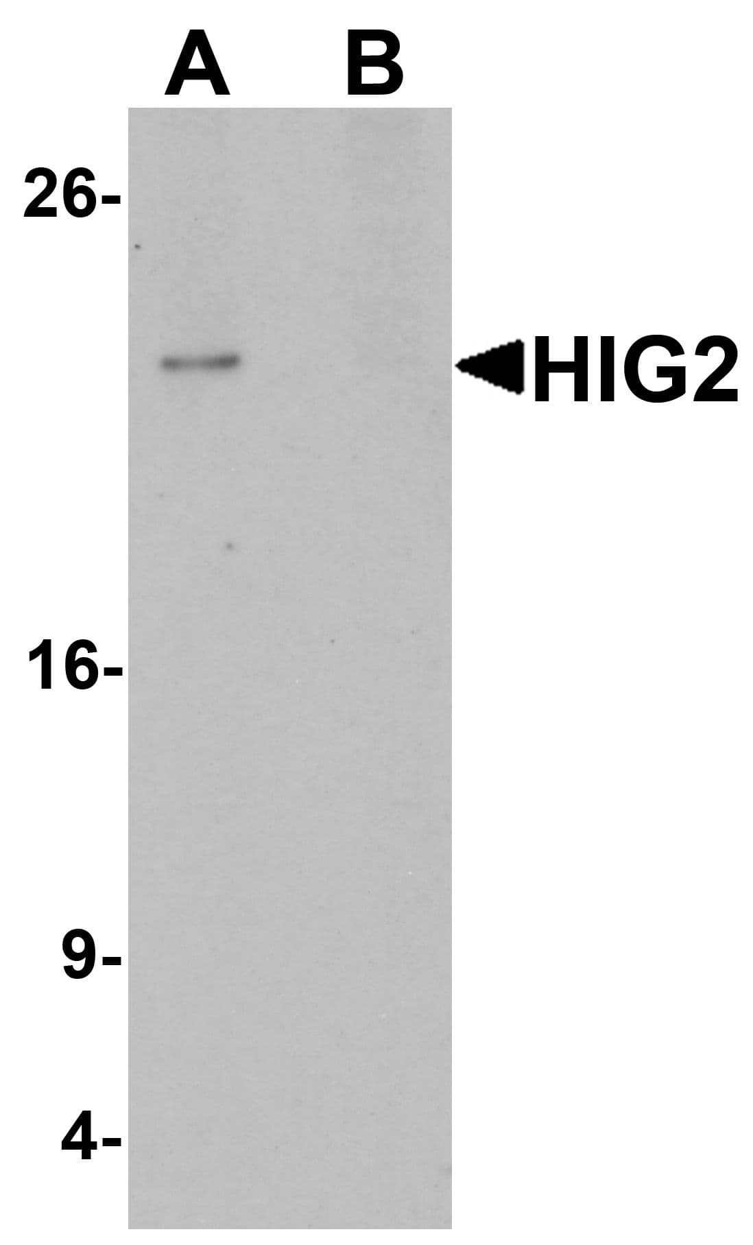 HILPDA / HIG2 Antibody